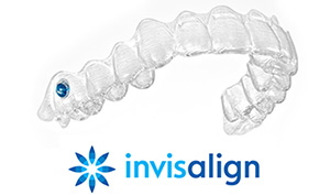 Invisalign - clear braces